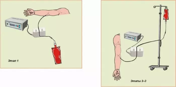 Использование магнитных полей в реаниматологии и интенсивной терапии