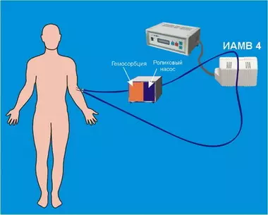Использование магнитных полей в реаниматологии и интенсивной терапии
